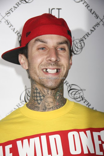 travis barker injured