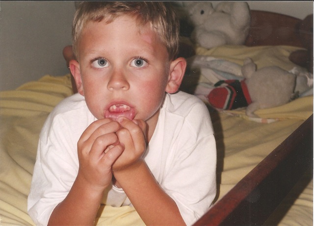 [Jesse missing tooth[3].jpg]