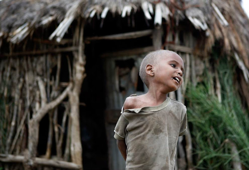 Life in Ethiopia: Heartbreaking Photos(big pictures)