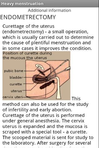 Heavy period