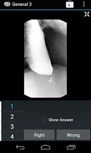 How to install Radiology Flashcards: General3 patch 1.4 apk for pc