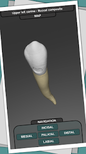 How to download CavSim - Dental Cavity Preps 1.0 unlimited apk for bluestacks