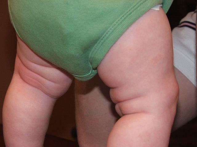 [ABP 4.5 Months 032[2].jpg]