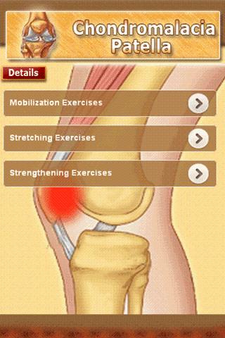 【免費健康App】Chondromalacia Patella-APP點子