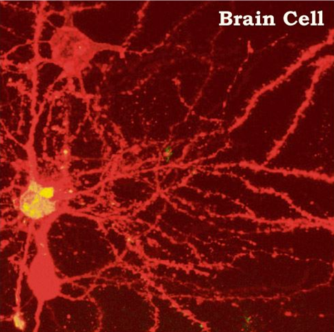 [FireShot capture #18 - 'A Brain Cell is the Same as the Universe' - sprott_physics_wisc_edu_pickover_pc_brain-universe_html[4].png]