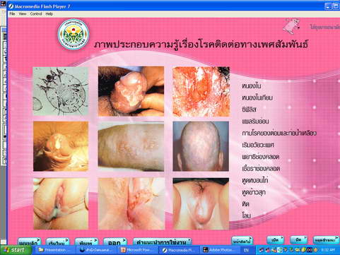[photo mblog bonkalasin]