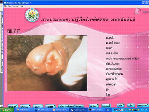 [photo mblog bonkalasin]