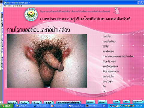 [photo mblog bonkalasin]