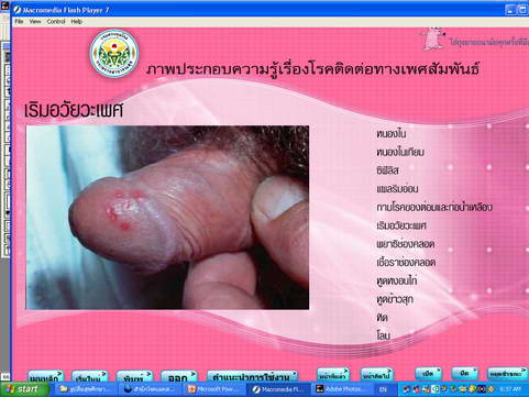 [photo mblog bonkalasin]