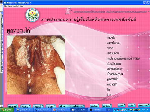 [photo mblog bonkalasin]