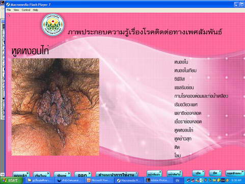 [photo mblog bonkalasin]