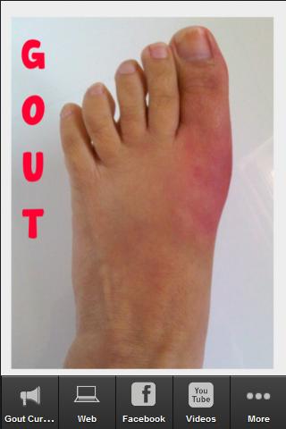 Gout Cure