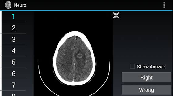 How to mod Radiology Flashcards: Neuro 1.4 unlimited apk for bluestacks