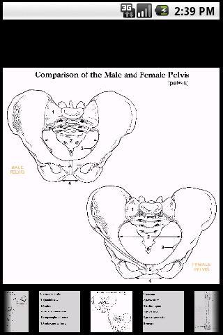 Bones - Med. IMAGE Flashcards