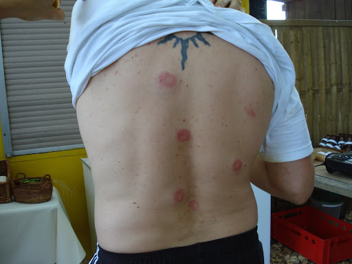 Paintball tut weh!