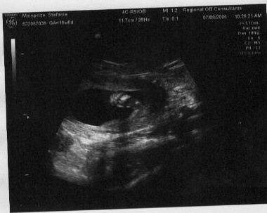 [baby foot[8].jpg]