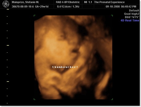 emilyultrasound 003
