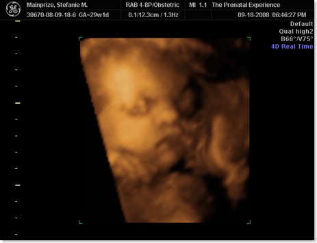 emilyultrasound 041