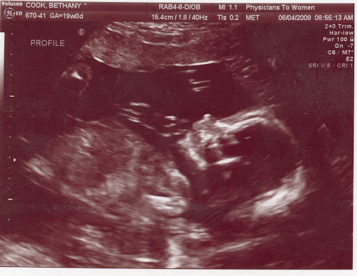 3d 4d ultrasound in new orleans