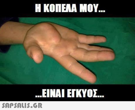 Η ΚΟΠΕΛΑ ΜΟΥ ΕΙΝΑΙ ΕΓΚΥΟΣ 