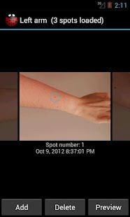How to mod Skin Monitor: check your moles lastet apk for laptop