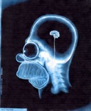 no-brain