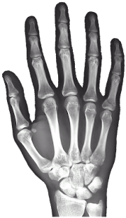 How to mod X-Ray Right Hand FREE 1.5 unlimited apk for bluestacks