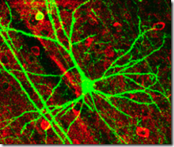 neuronas