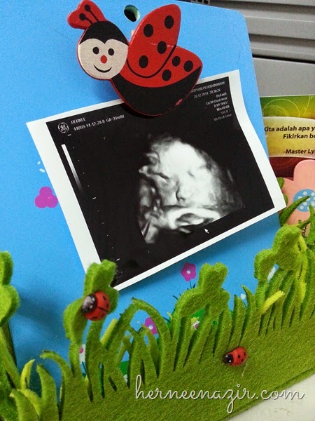 Pregnancy | Abang Ilham Yang Excited Tengok Adik Baby ;)