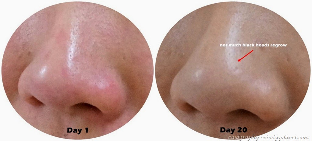 [Cellnique%2520Skin%2520Action%2520Sebum%2520Gel%2520review%2520nose%255B2%255D.jpg.webp]