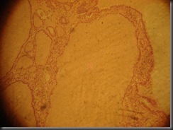 Colloid Goitre- high resolution histology slide tsnaps