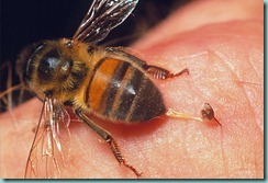 bee-sting-symptoms