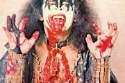 Kiss
