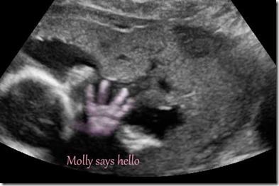 Hello Molly 23w2d