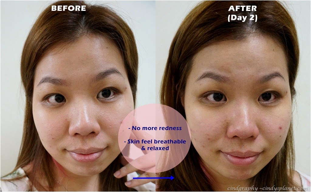 [cellnique%2520O2%2520derma%2520result1%255B2%255D.jpg.webp]