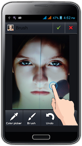 Acne Remover -PhotoEditor