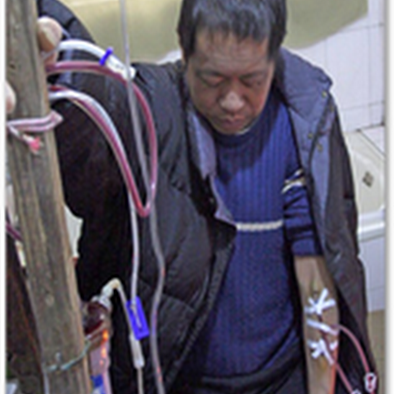 Chinese Man Builds Homemade Dialysis Machine To Keep Himself Alive for 13 Years As He Could Not Afford Treatment