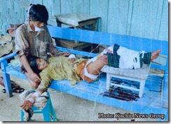 Kachin civilian injured by Burma army mine