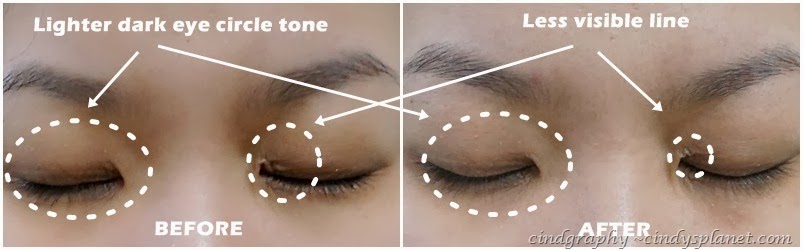 [Evolu%2520eye%2520lip%2520serum%2520result%255B2%255D.jpg.webp]