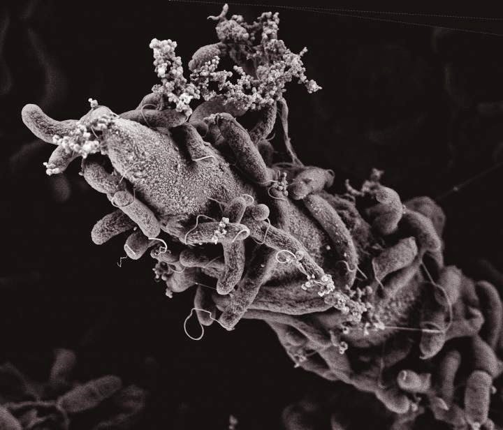 Microscopia Eletrônica de Vibrio cholerae em meio de quitina