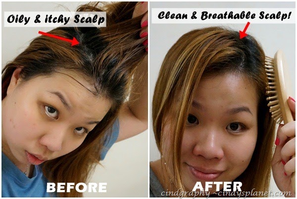 [diy%2520itchy%2520scalp%255B2%255D.jpg.webp]