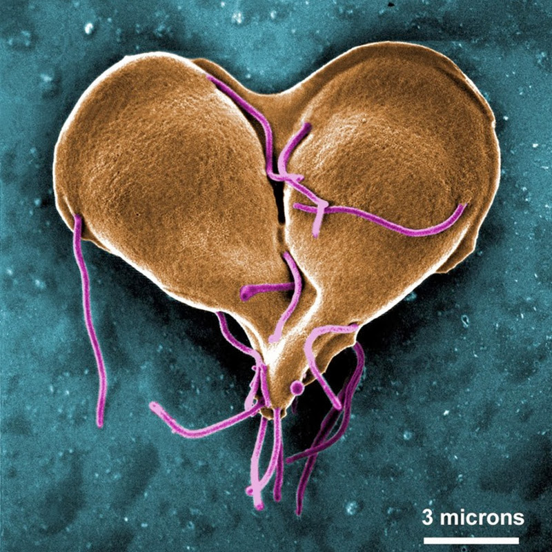 giardia cdc dpdx)