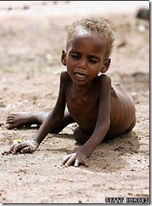 Somalia Famine Child