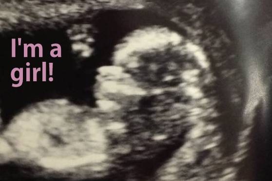 baby 12 weeks ultrasound 2