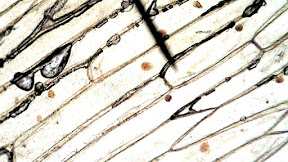 44 onion cells under microscope with labels
