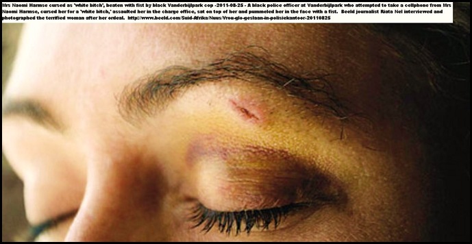 Harmse Naomi Vanderbijlpark cop beat her in the face with his fist Aug 25 2011