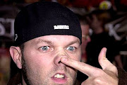 Fred Durst