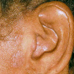 01 - 2006 - jan Foto de gente humilde tentando mostrar o problema.jpg