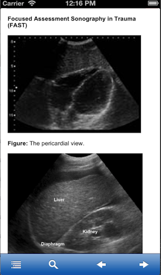    Advanced Trauma Life Support- screenshot  