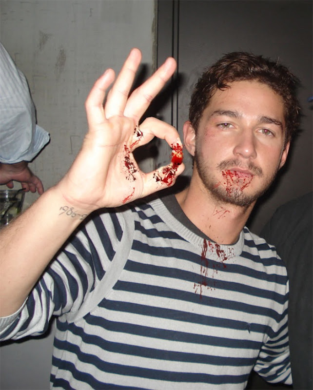 shia-labeouf-pulls-tooth-picture_thumb%25255B1%25255D.jpg